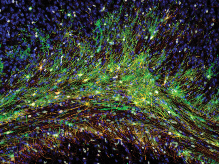 Human brain cells in a mouse glow green because researchers have tagged them with a gene that looks green under fluorescent light. Mice with the human cell transplants were smarter than normal mice, the researchers report.