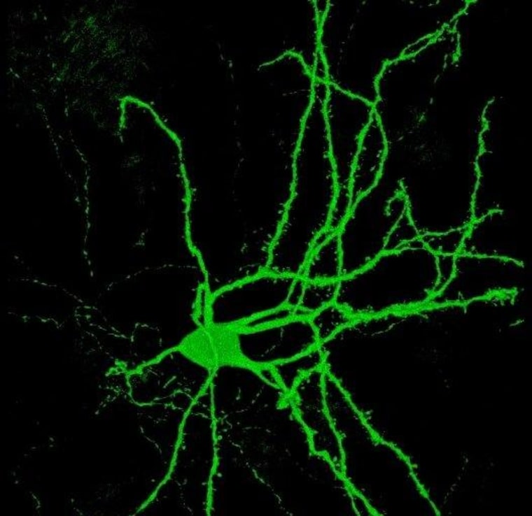 The brain's building block: a spiny neuron.