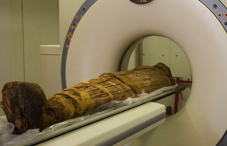 Researchers conduct an MRI on a mummy from Egypt, in search of evidence of clogged arteries.