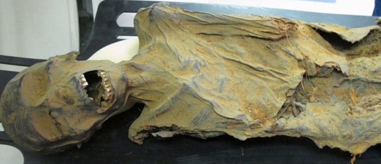 This mummy shows signs of heart disease, researchers, found