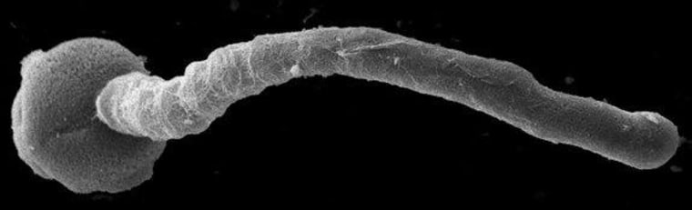 A pollen grain extending a pollen tube.