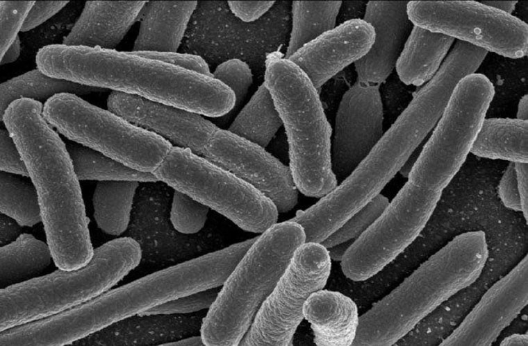 Professors at the Microbial Evolutionary Ecology at the University of Zürich investigated the suicidal behavior of E. coli cells (above).