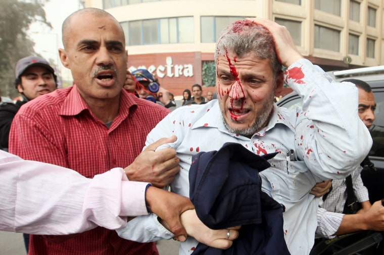An injured Egyptian anti-Muslim Brotherhood protester is taken away by fellow protesters during clashes near the Muslim Brotherhood's national headquarters in Cairo on March 22, 2013.