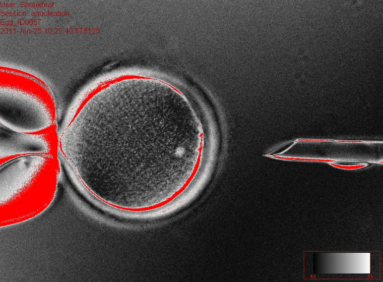 PHOTO E - Donor egg held by pipette prior to nuclear extraction