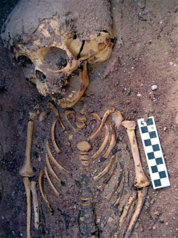 A close-up of the upper body of burial 519, the 2,000-year-old remains of an abused toddler found in Egypt.