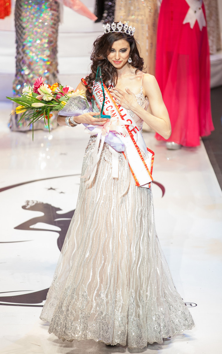 Denise Garrido, 26, initially was named Miss Universe Canada before it was discovered that a typo made while tabulating results meant that she had actually finished fourth. etermined that she had actually finished fourth.
