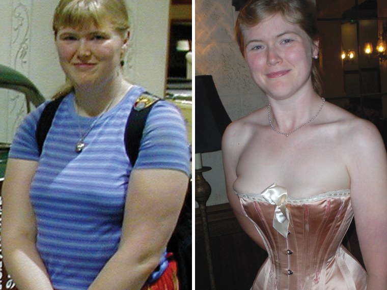 Then and now: Chrisman before and after she adopted wearing a corset. She says the undergarment has helped her shed significant weight.