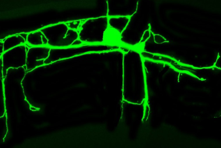 The tree-like structure of dendrites with a defective gene.