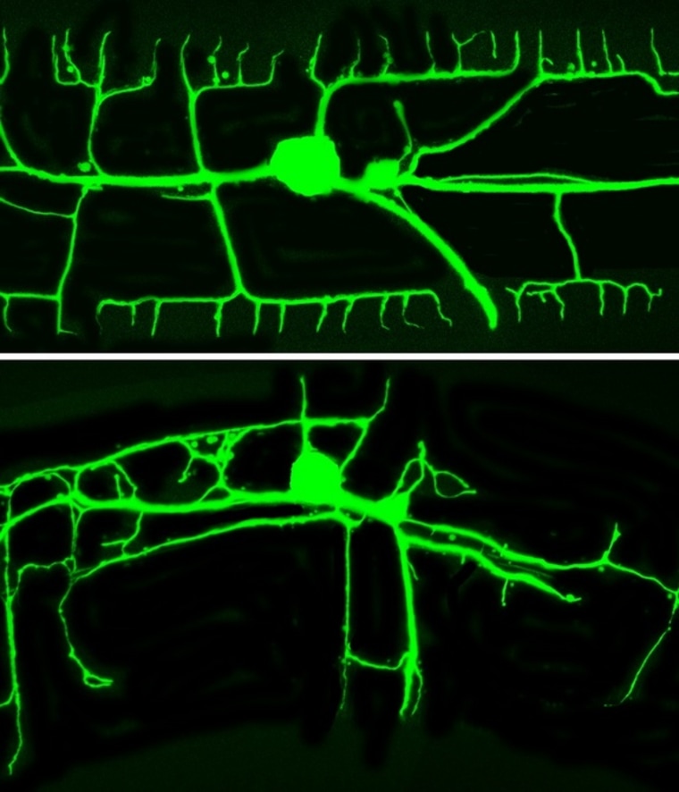 The tree-like structure of dendrites in a normal Caenorhabidtis elegans roundworm (top) and one with a defective gene (bottom).
