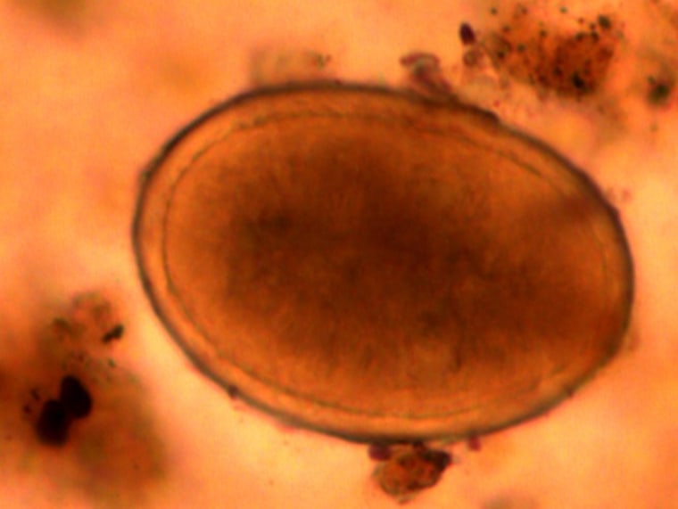 The hardy eggs of the intestinal parasite Ascaris Lumbricoides, or the roundworm, was found in samples taken from Richard III's gut.