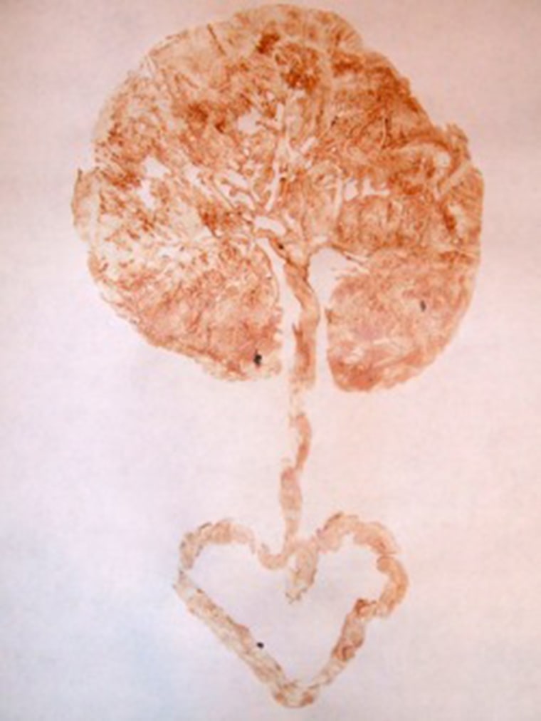 Placenta print