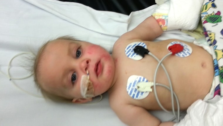 Wyatt Scott was born with congenital trismus.