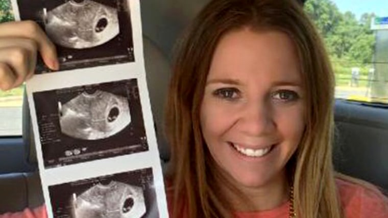 Rachelle Friedman Chapman holds up ultrasound pictures of her baby, which is being carried via surrogate.