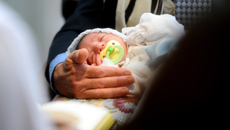 A newborn closes his eyes during his circumcision ceremony. The rate of circumcision in the U.S. has fallen.