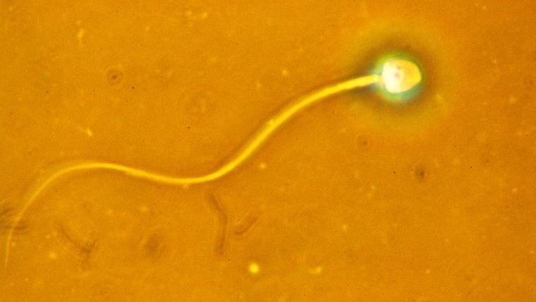Sperm cell.