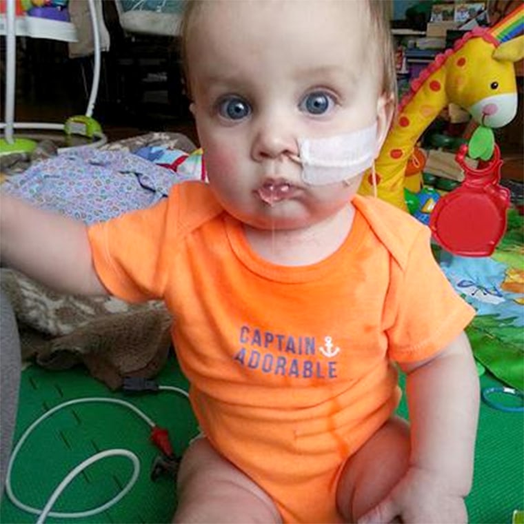 Doctors have been unable to figure out why Wyatt was born unable to open his mouth.