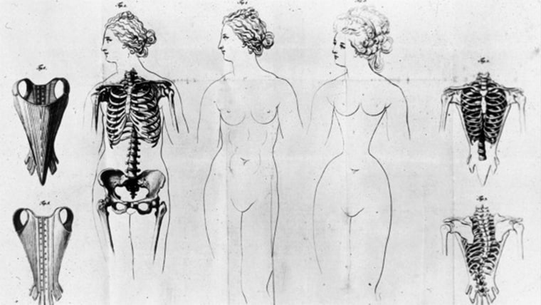 Illustration of how corsets squeezed women's ribs