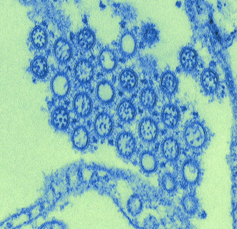 2009
Cynthia Goldsmith

This highly-magnified, digitally-colorized transmission electron micrograph (TEM) depicted numbers of virions from a Novel Flu...