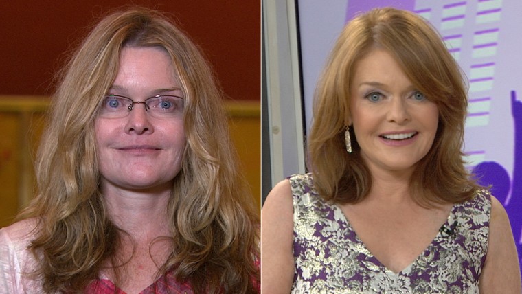 Before/after Ellen