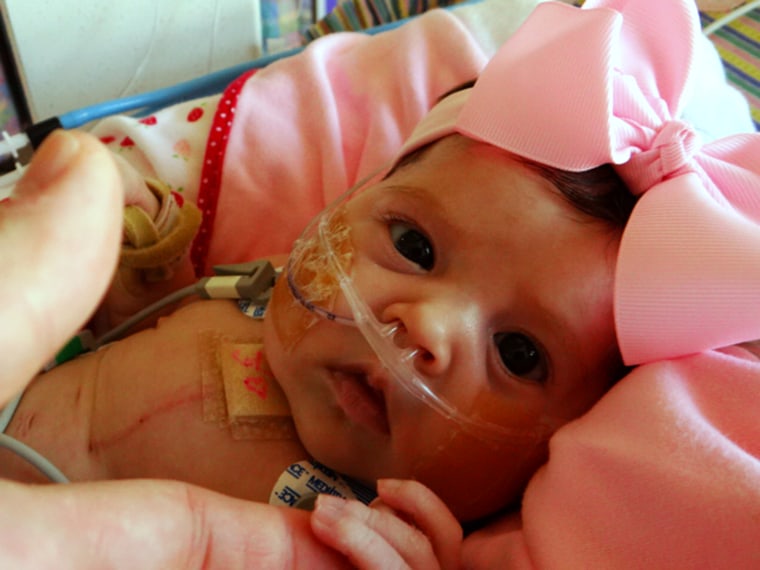 Juliana Graves got a heart transplant 17 days after she was born.