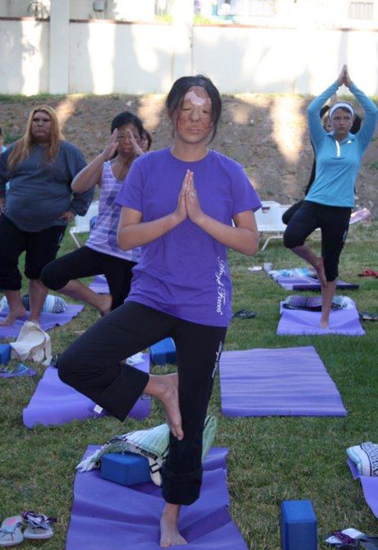 Jessa Xiaoli practices yoga at the retreat.