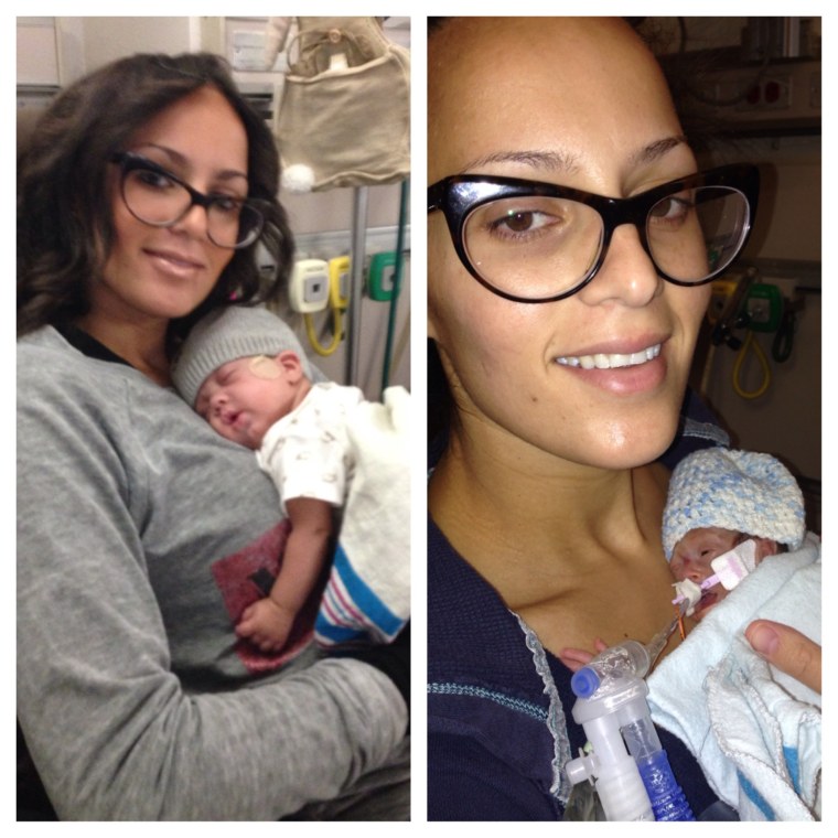 A before and after photo of Elene with Carl at about 14 days old, left, and with Carl right before NICU discharge, right.