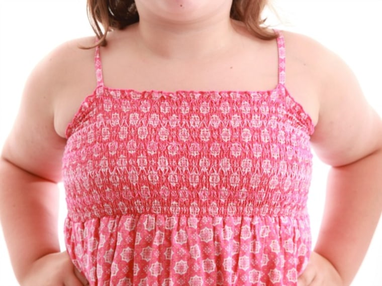 Childhood Obesity Linked to Earlier Puberty in Girls