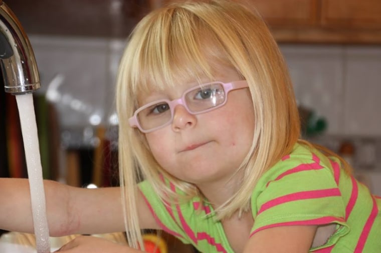 Helen, age 3, has worn glasses since 15 months.