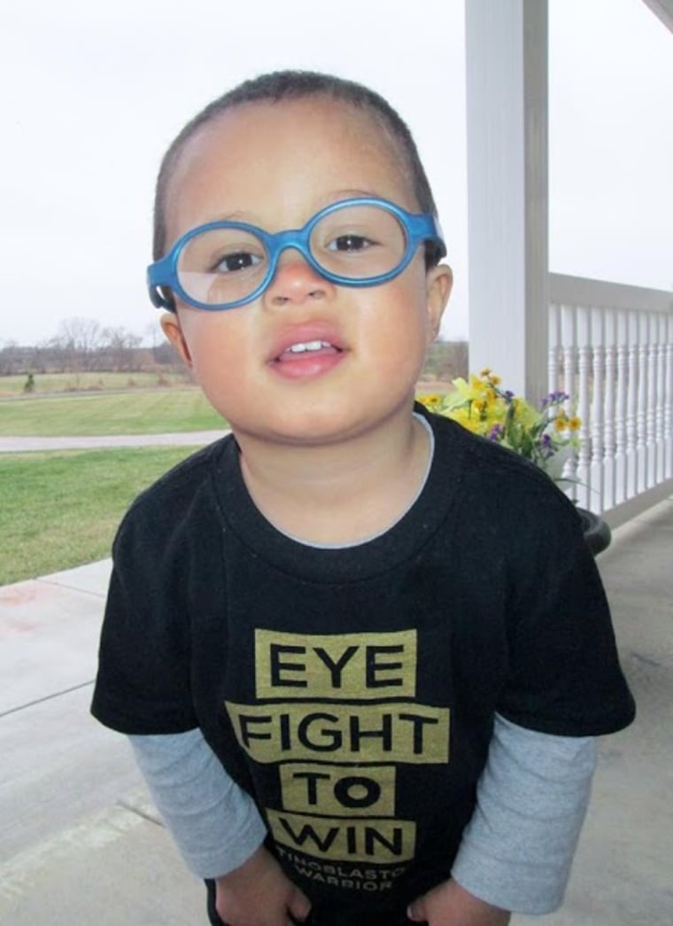 Jayden, 2 years old, is rocking a prosthetic eye (he had an eye removed at 17 months) and glasses.