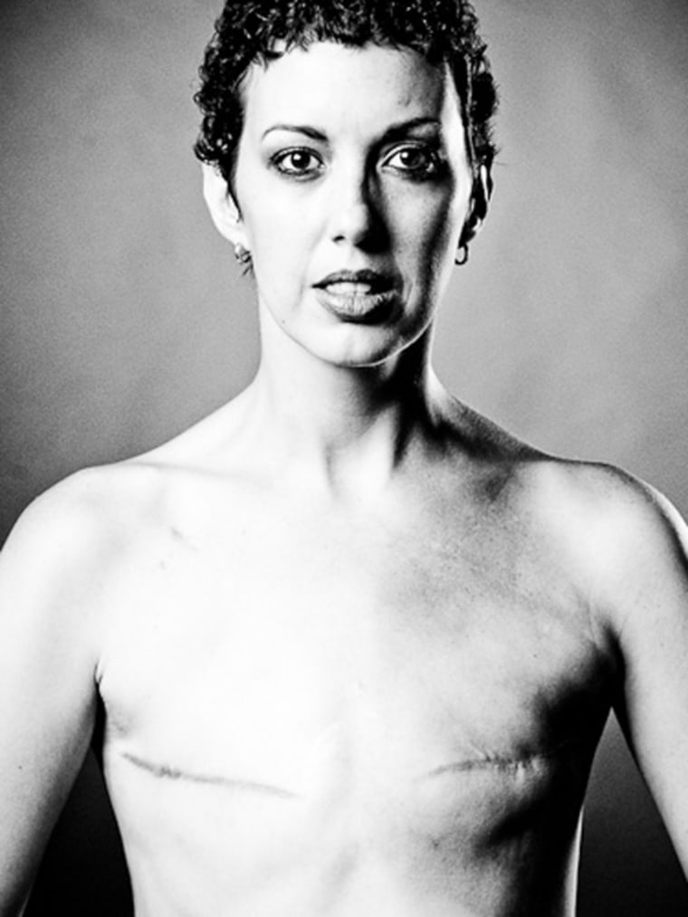 The SCAR Project: What breast cancer really looks like