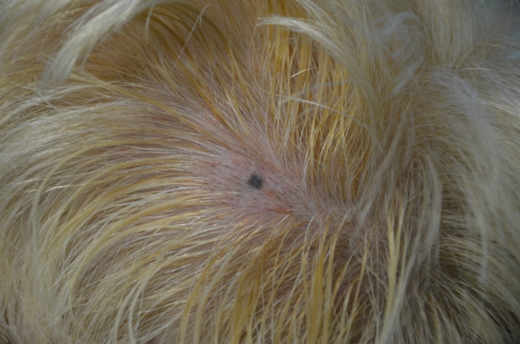 Dr. Deborah Sarnoff's scalp