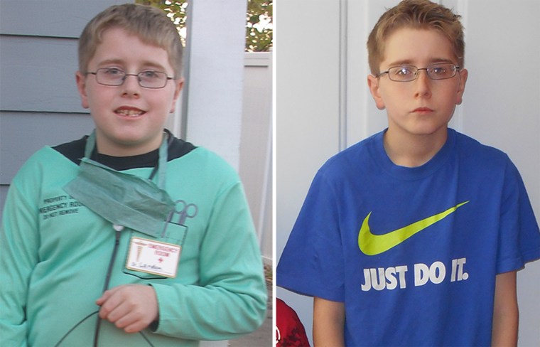 Landon Jones before and after his mysterious lost of appetite and thirst.