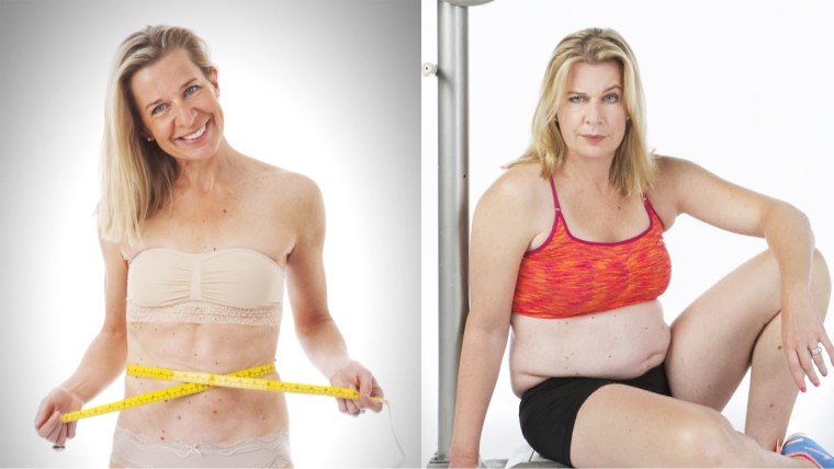 Katie Hopkins before and after she intentionally gained 50 pounds