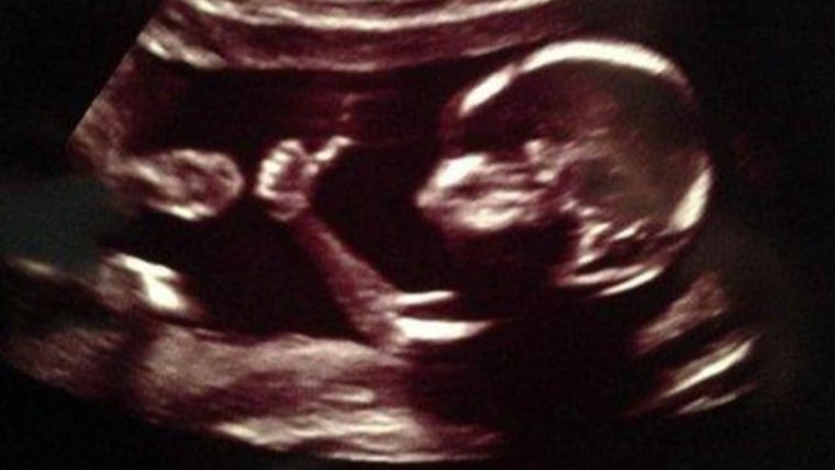 Aaaay! The \"Fonzie fetus\" has become a social media darling.