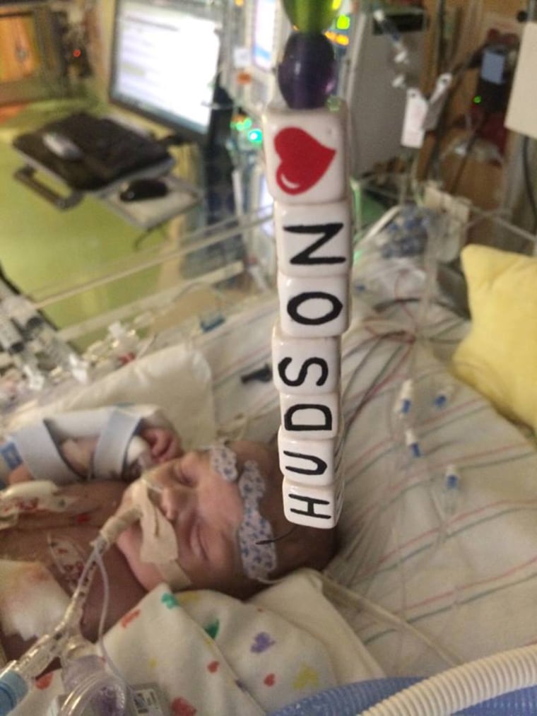 The timetable for when Hudson will receive a heart transplant is unclear. \"It could be tomorrow, it could be months,'' his father said.