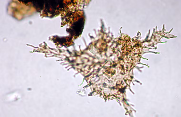 This image shows one type of tropical plankton discovered by researchers from the Integrated Ocean Drilling Program during an expedition to the North Pole, and new findings from the research are being detailed in the June 1 issue of Nature magazine. The remains of the tropical organisms were found in the first core samples ever taken from the bottom of the Arctic Ocean. The discovery is part of a treasure trove of scientific data revealing detailed information about conditions of subtropical warmth at the North Pole about 55 million years ago. The findings are providing a window into the future, when greenhouse gases are expected to reach the same levels that caused Earth's ancient heat wave. (Henk Brinkhuis, Utrecht University, the Netherlands)