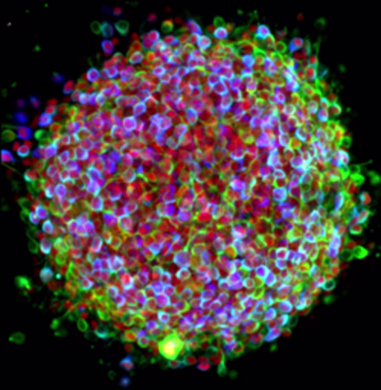 A cluster of induced pluripotent stem cells (iPS cells)