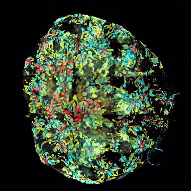 Image of a mini-kidney formed in a dish from human induced pluripotent stem cells.