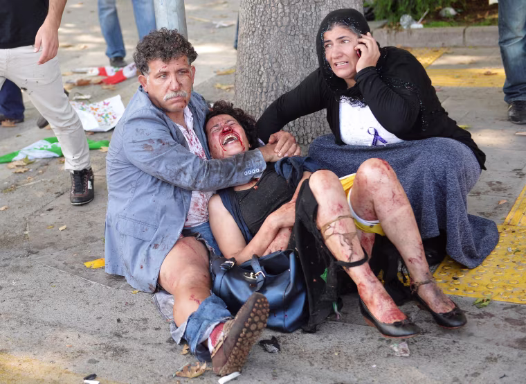 Image: Twin blasts kill at least 30 in Turkish capital ahead of peace rally