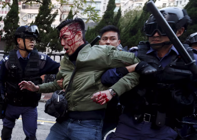 Image: An unidentified injured man is escorted by riot police at Mongkok in Hong Kong