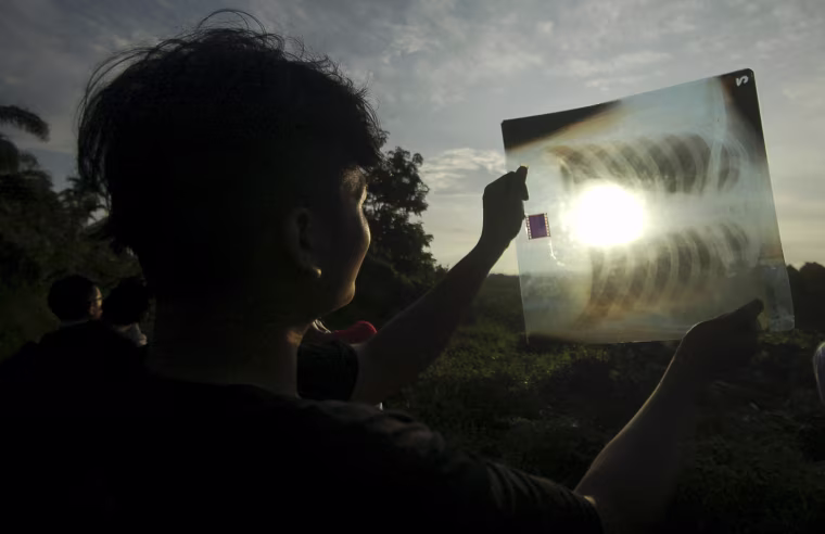 Image: A person uses a medical X-ray film to view the sun during a solar eclipse in Silaut