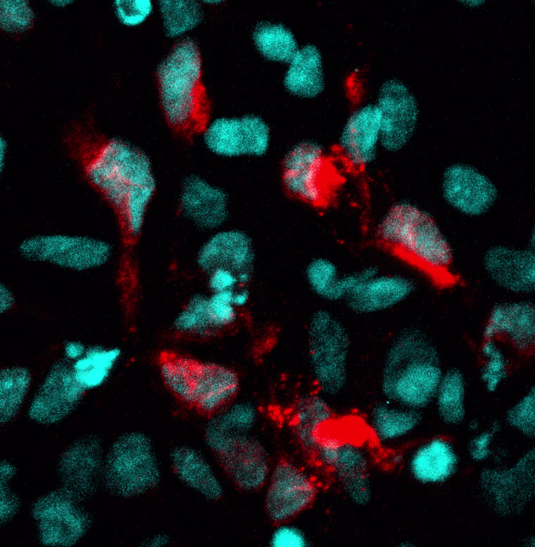 Confocal microscopy of human neural stem cell culture infected with Zika virus (red). Cell nuclei are shown in blue.