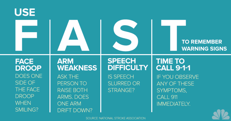 INFOGRAPHIC-stroke symptoms-today-160108