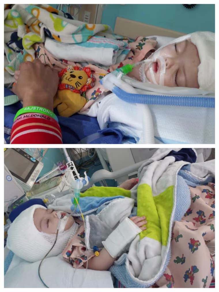Jadon and Anias after the Oct. 12 surgery.