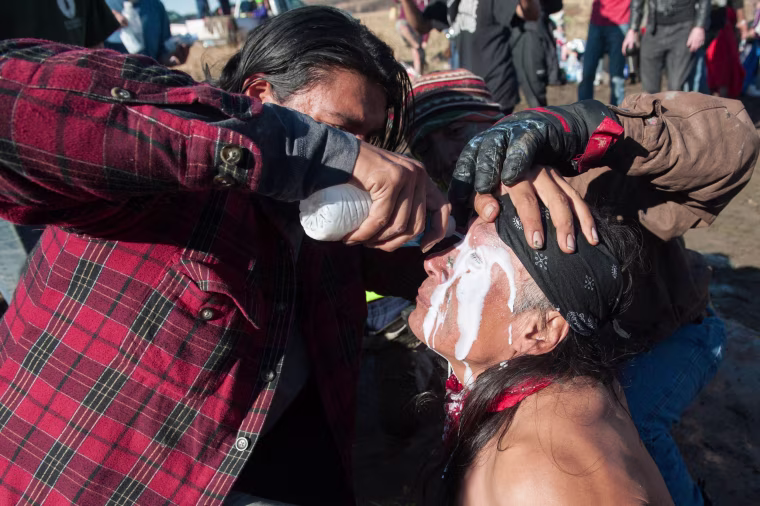 Image: A person pours a pepper spray antidote into a protester's eyes during a protest against the building of a pipeline on the Standing Rock Indian Reservation near Cannonball, North Dakota