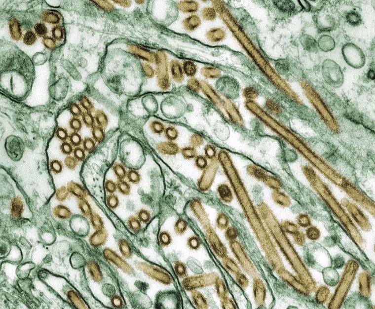 A new study explains why children and young adults are more likely to be infected with H5N1, shown here, while H7N9 disproportionately affects older adults.