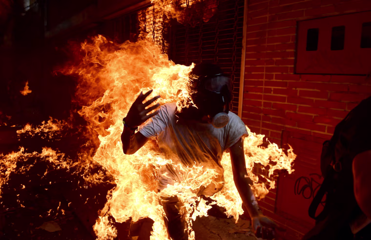 Image: A demonstrator catches fire during clashes with riot police in Caracas on May 3, 2017.