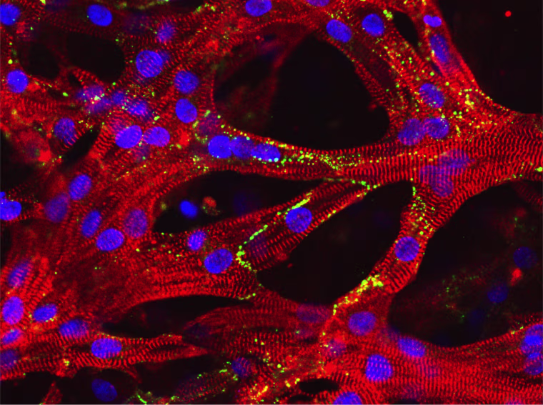 The heart muscle patch seen through a microscope. The striped patterns are muscle fibers, the large blue dots are proteins, and the green dots represent patterns of electrical signalling.