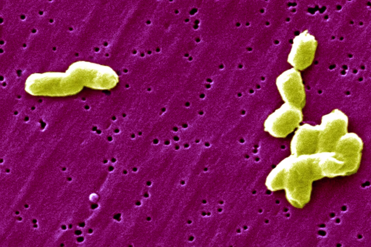 Image: Salmonella Infantis