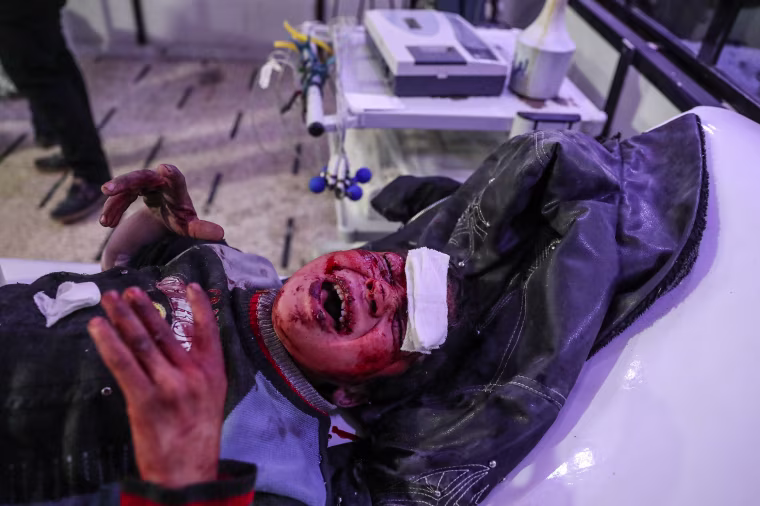 An injured child cries out while being treated for his injuries on Feb. 19.